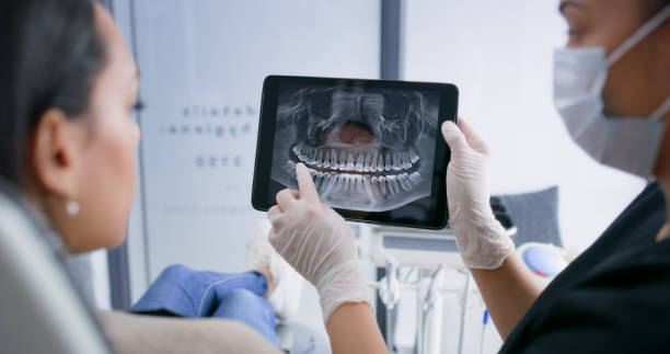 Licensed Root Canal Treatment service in Lakewood, OH - Smile Center Dentistry